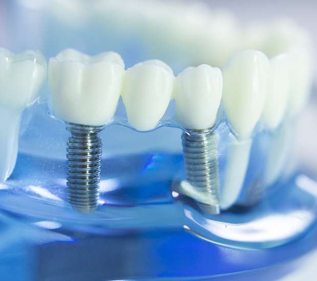 Independence Dental Implants